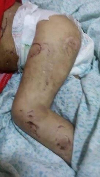 بالصور: وحش بشري .. أب ينهش جسدي طفلتيه ككلب مسعور في العراق بالصور: وحش بشري .. أب ينهش جسدي طفلتيه ككلب مسعور في العراق