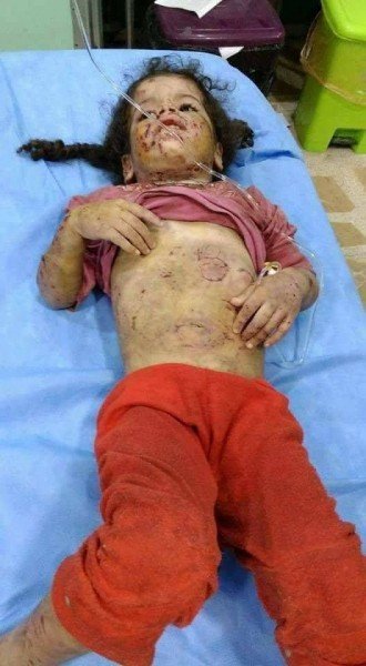 بالصور: وحش بشري .. أب ينهش جسدي طفلتيه ككلب مسعور في العراق بالصور: وحش بشري .. أب ينهش جسدي طفلتيه ككلب مسعور في العراق